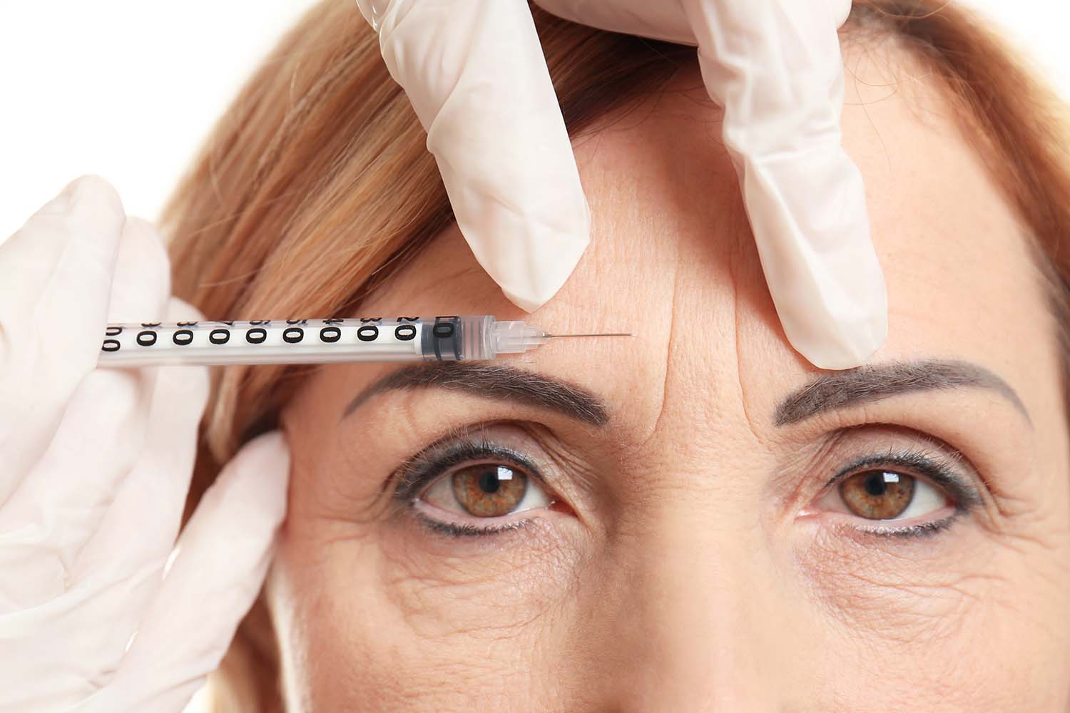 Woman recieving Botox injection in forehead